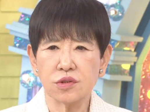 和田アキ子の最新顔画像,2022年眼瞼下垂